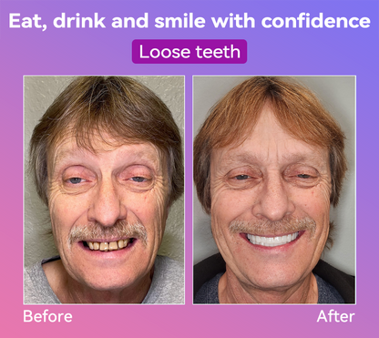 𝐉𝐚𝐬𝐬𝐞𝐞𝐦® Latest Premium Comfort Dentures🎉 (High-End Dentures, Easy to Wear - Limited Time 70% Discount)🔥