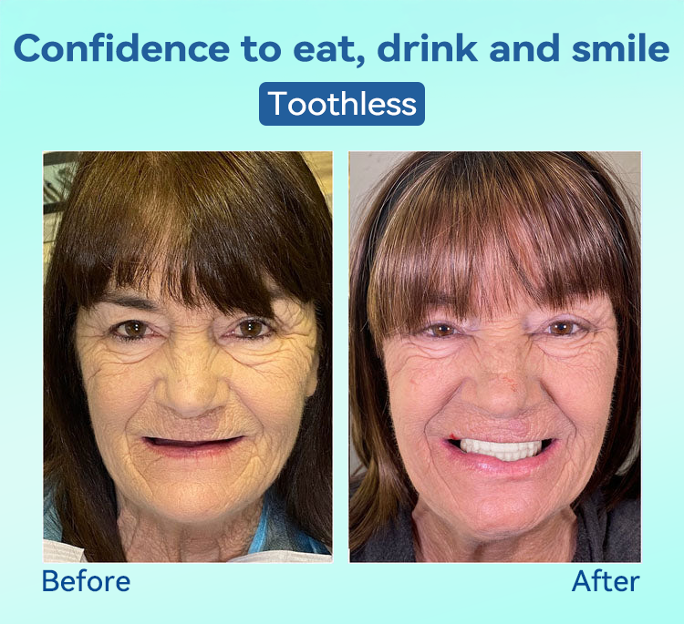 𝐁𝐢𝐤𝐞𝐧𝐝𝐚®🍀𝐏𝐫𝐞𝐦𝐢𝐮𝐦 𝐃𝐞𝐧𝐭𝐮𝐫𝐞(🦷𝐋𝐢𝐦𝐢𝐭𝐞𝐝 𝐭𝐢𝐦𝐞 𝐝𝐢𝐬𝐜𝐨𝐮𝐧𝐭 𝐋𝐚𝐬𝐭 𝟑𝟎 𝐦𝐢𝐧𝐮𝐭𝐞𝐬🦷)