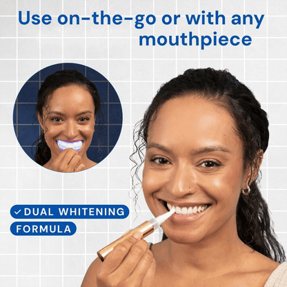 Whitening Pen for Stain Removal & Whiter Teeth(🔥LAST DAY SALE-80% OFF)