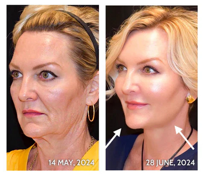 Final 3 Hours: 60% OFF🔥 4 In 1 Color Changing Foundation