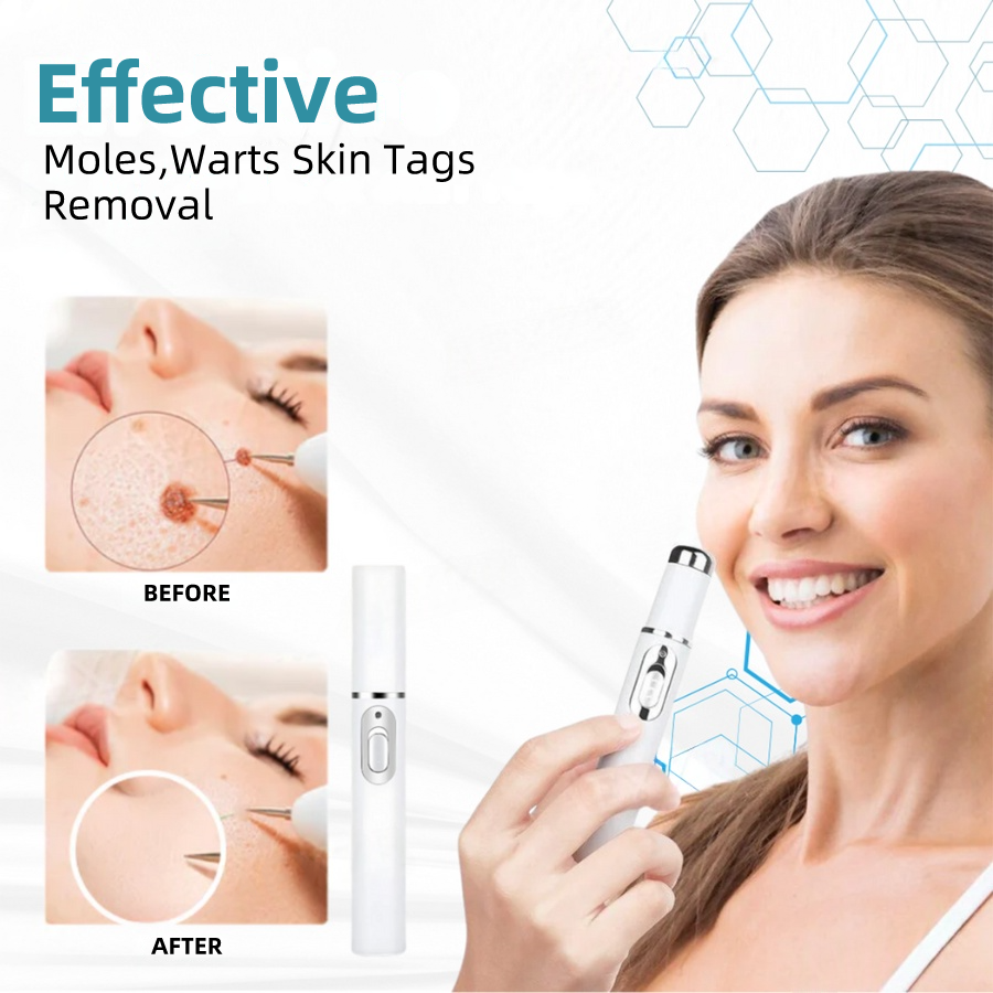𝐉𝐚𝐬𝐬𝐞𝐞𝐦® Medical-Grade Laser Pen 💕 (Powered by CO₂ laser technology – effectively removes moles, warts, skin tags, pigmentation spots, and other skin imperfections)🔥