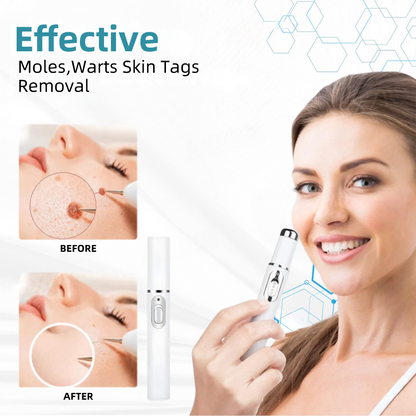 𝐉𝐚𝐬𝐬𝐞𝐞𝐦® Medical-Grade Laser Pen 💕 (Powered by CO₂ laser technology – effectively removes moles, warts, skin tags, pigmentation spots, and other skin imperfections)🔥