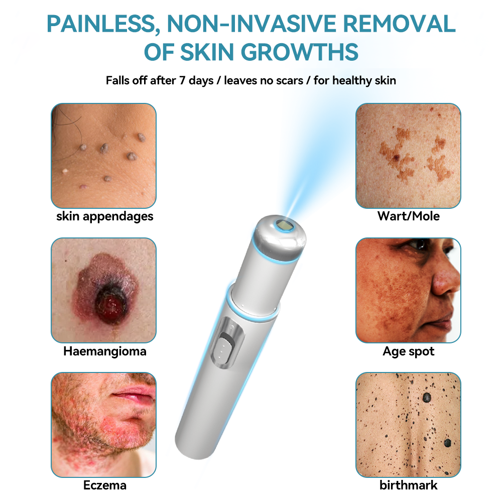 𝐉𝐚𝐬𝐬𝐞𝐞𝐦® Medical-Grade Laser Pen 💕 (Powered by CO₂ laser technology – effectively removes moles, warts, skin tags, pigmentation spots, and other skin imperfections)🔥