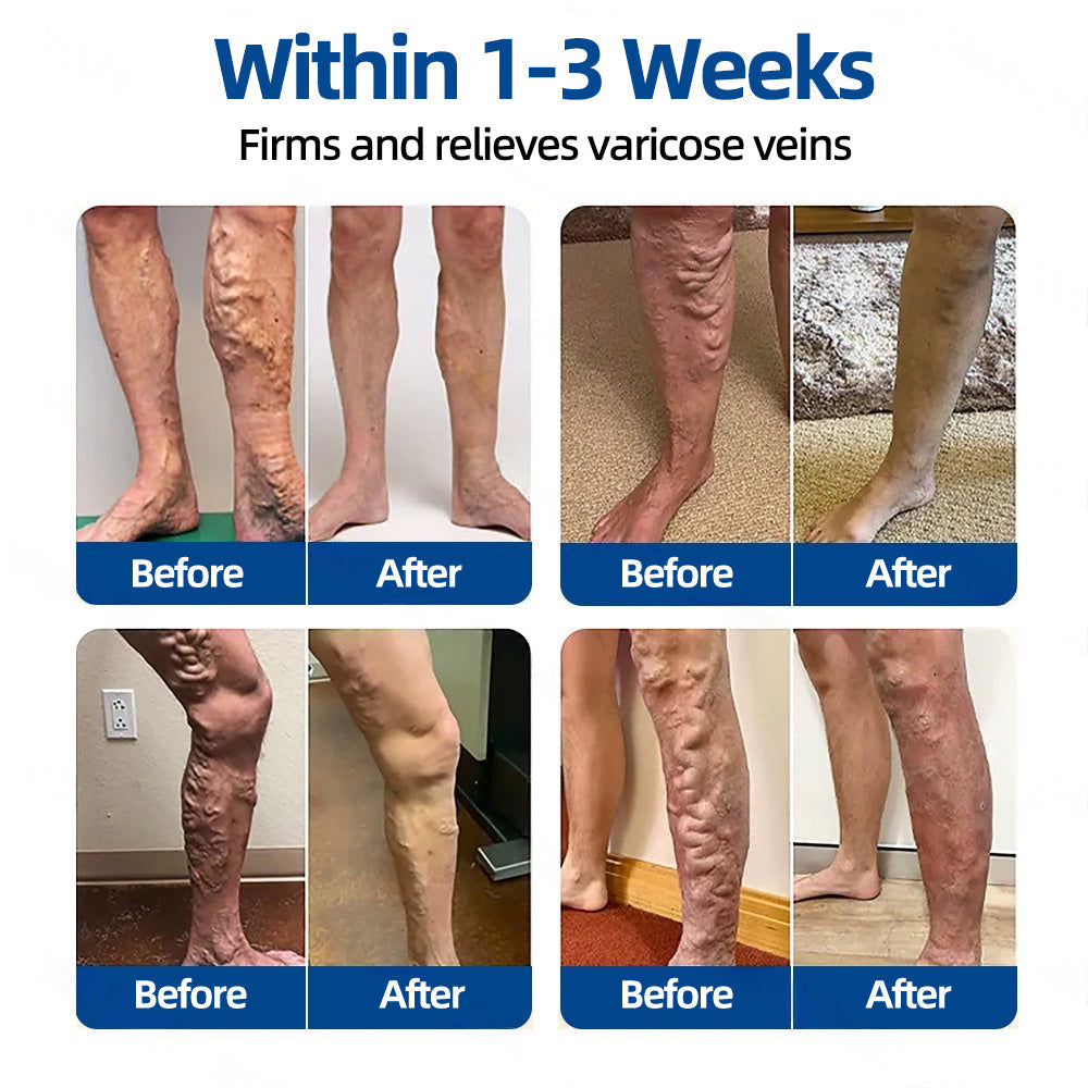 🛡️ 𝐅𝐥𝐨𝐫𝐢𝐬𝐦𝐚®💕𝐕𝐞𝐢𝐧𝐓𝐚𝐫𝐠𝐞𝐭 𝐌𝐢𝐜𝐫𝐨𝐧𝐞𝐞𝐝𝐥𝐞 𝐏𝐚𝐭𝐜𝐡⚡Instant Relief, Long-Term Results👩‍⚕️
