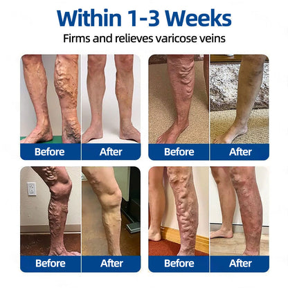 🛡️ 𝐅𝐥𝐨𝐫𝐢𝐬𝐦𝐚®💕𝐕𝐞𝐢𝐧𝐓𝐚𝐫𝐠𝐞𝐭 𝐌𝐢𝐜𝐫𝐨𝐧𝐞𝐞𝐝𝐥𝐞 𝐏𝐚𝐭𝐜𝐡⚡Instant Relief, Long-Term Results👩‍⚕️