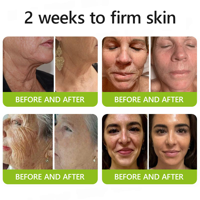Official Store | Rejuvenate Your Skin Instantly 💫 STDEI® BOTOX & VITA A RETINOL SHOT Anti-Wrinkle Lifting & Firming Cream