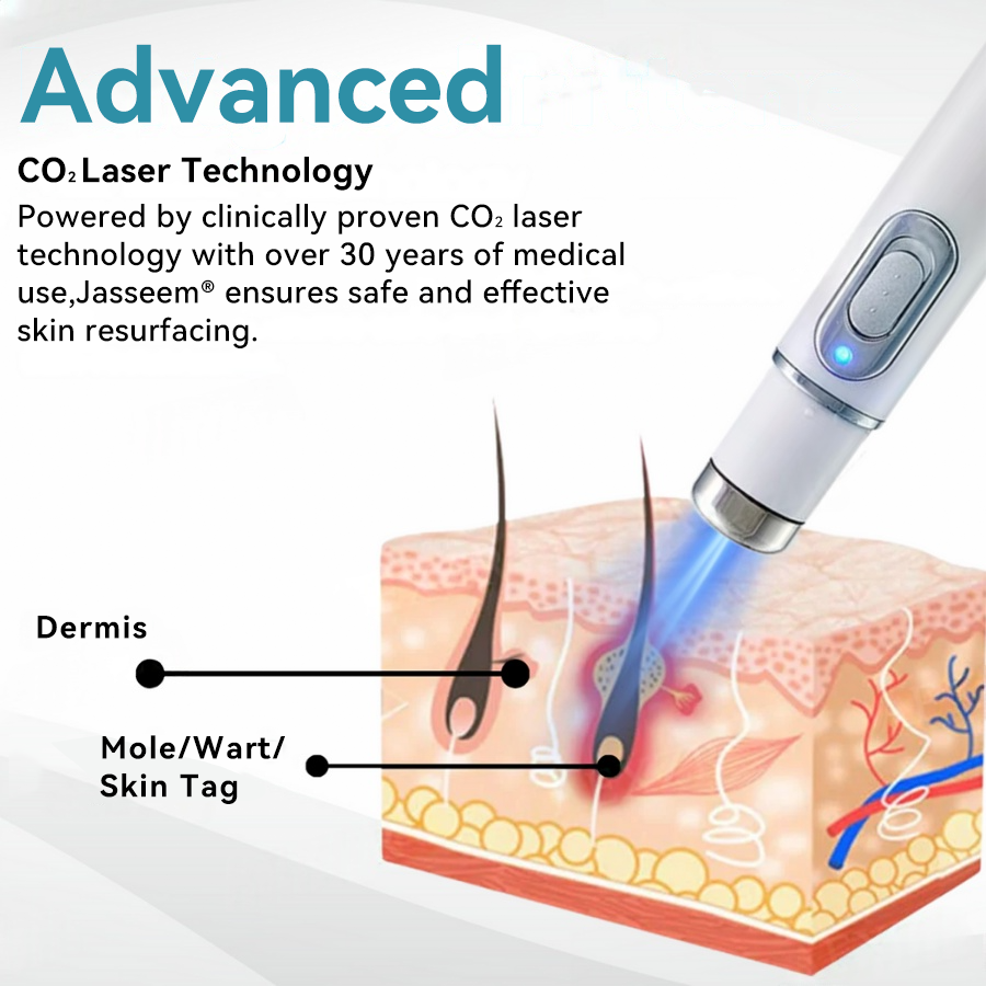 𝐉𝐚𝐬𝐬𝐞𝐞𝐦® Medical-Grade Laser Pen 💕 (Powered by CO₂ laser technology – effectively removes moles, warts, skin tags, pigmentation spots, and other skin imperfections)🔥
