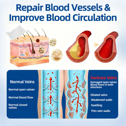🛡️ 𝐅𝐥𝐨𝐫𝐢𝐬𝐦𝐚®💕𝐕𝐞𝐢𝐧𝐓𝐚𝐫𝐠𝐞𝐭 𝐌𝐢𝐜𝐫𝐨𝐧𝐞𝐞𝐝𝐥𝐞 𝐏𝐚𝐭𝐜𝐡⚡Instant Relief, Long-Term Results👩‍⚕️